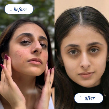 Morning Vitamin Smoothie Serum.